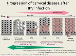 HPV and Cervical cancer progression
